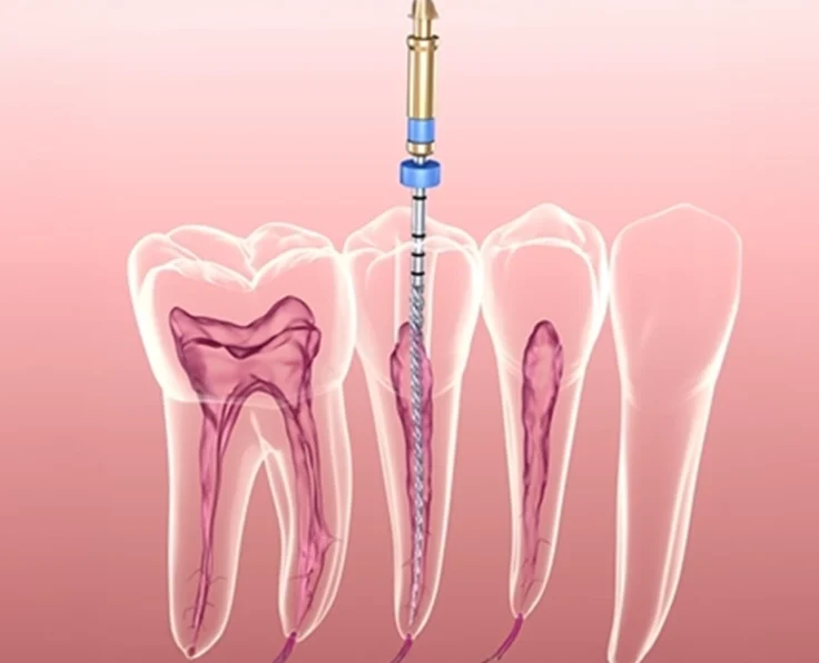 sv3-copy12 copy21298999